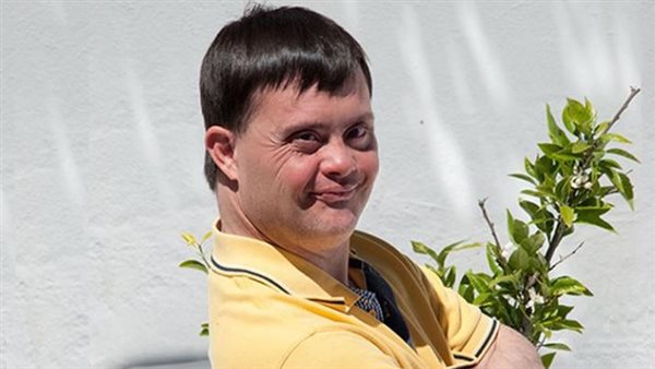 مصاب بمتلازمة داون_