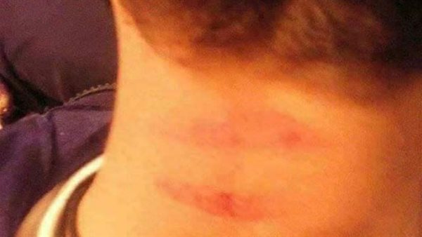 الطالب المعتدى عليه