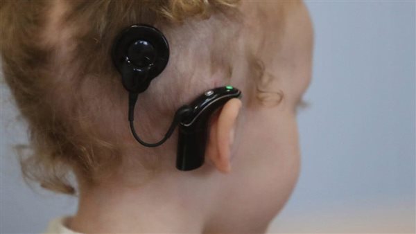 زراعة القوقعة 