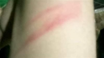 مصدر أمني بـ واقعة اتهام طالب لوالدته وزوجها بالضرب ببنها: الأم كانت تدافع عن نفسها 