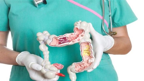 أعراض القولون العصبي