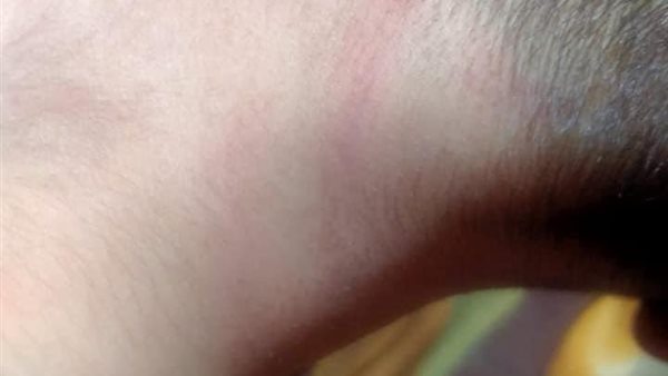 الطفل المعتدي عليه