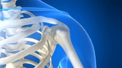 استشاري يوضح أسباب وطرق علاج مرض العظم الزجاجي