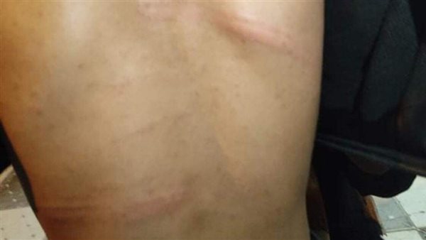 مدرس يتعدي وحشيا