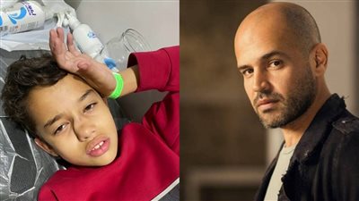 بسبب لعبة في الملاهي.. إصابة نجل الفنان أبو بـ كسر في الأنف | فيديو جراف