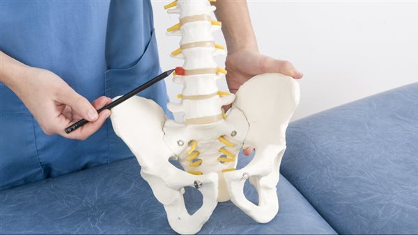 علاج غضروف الظهر