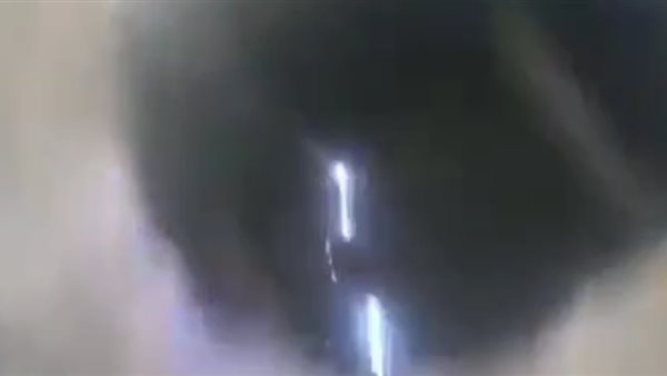 سقوط طفل في بلاعة