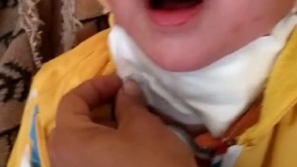 الطفل المصاب 