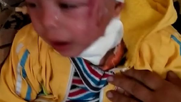 الطفل المصاب