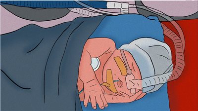 جشع طبي أو تساهل.. مشرط القيصرية يلقي بالمواليد إلى حاضنات مفقودة