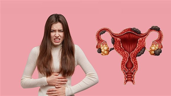 انفجار كيس الشوكولاتة