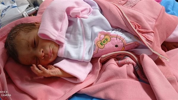 طفلة حديثة الولادة