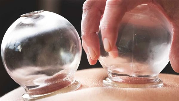 علاج أكياس الشوكولاتة