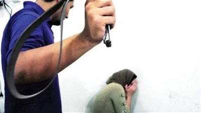 خبير قانوني يوضح عقوبة ضرب الزوجة 