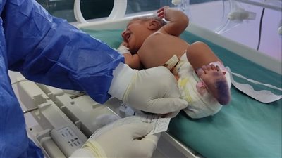 الرعاية الصحية تشارك بـ 8 مستشفيات للكشف الأمراض الوراثية لـ 1000 طفل حديثي الولادة