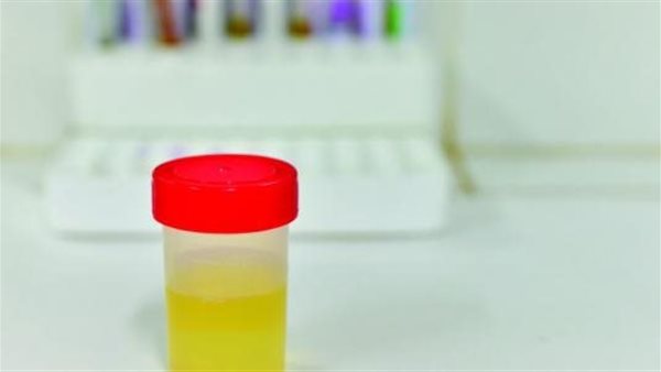 مدة علاج صديد البول