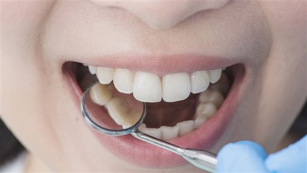 مشاكل الأسنان