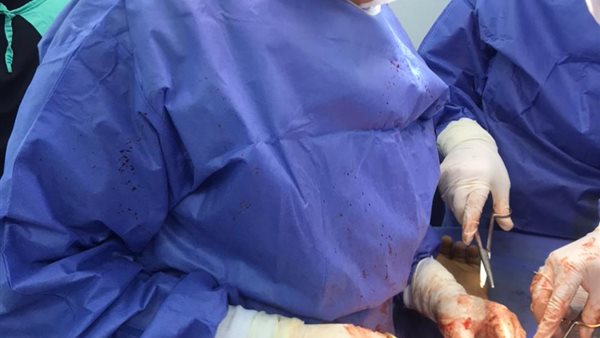 جانب من الجراحة