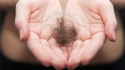 متى يكون تساقط الشعر خطير ومقلق؟ 4 نقاط مهمة تحدد الإجابة