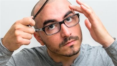 مراحل تساقط الشعر للرجال.. ونصائح مهمة لتأخير الصلع الوراثي 