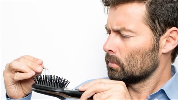 تساقط الشعر