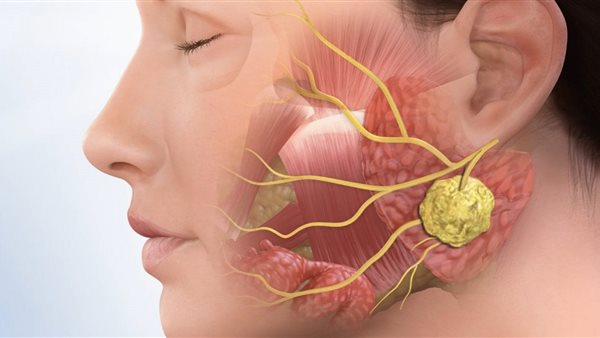 عضلة في الفك