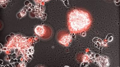 دراسة تثبت انتقال فيروس كورونا إلى القلب والدماغ بعد أيام من الإصابة