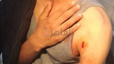 بسبب أولوية ركن السيارة.. طالب يعتدي على زميله بسلاح أبيض بجامعة المستقبل | صور 