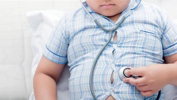 السمنة لدى الأطفال