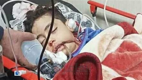 إصابة 3 أطفال إثر