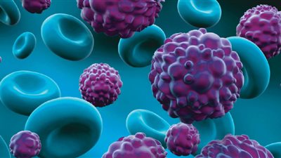 عملية جديدة تعالج سرطان البروستاتا.. تعرف عليها |دراسة