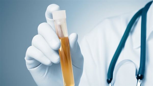 كثرة التبول