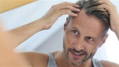 كيف يمكن أن يصيب التوتر بالثعلبة وتساقط الشعر؟