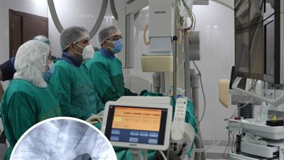 الرعاية الصحية: إنقاذ حياة رضيع عمره شهر ونصف يعاني عيب خلقي بالقلب 