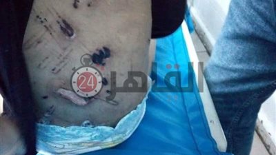 قصة حبس سيدة عذبت حفيدتها بكي أعضاءها التناسلية بالدقهلية لتبولها لا إرادياً (صور)