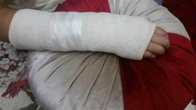 بسبب التدافع في الطابور.. استبعاد مديرة مدرسة بالدقهلية بعد كسر يد طالبة