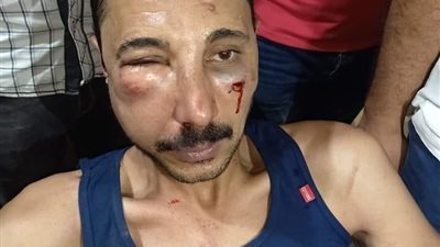 حبس الضابط المعتدي على محامي المحلة 4 أيام بتهمة الشروع في القتل