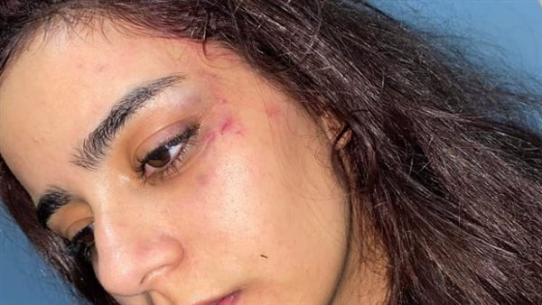 حياة عبدالله - الضحية