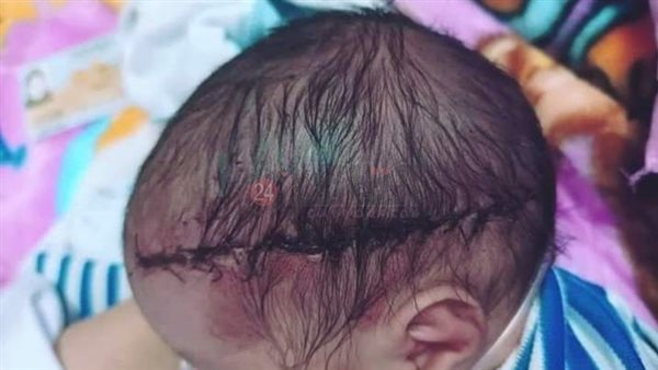 الطفل ضحية الإهمال