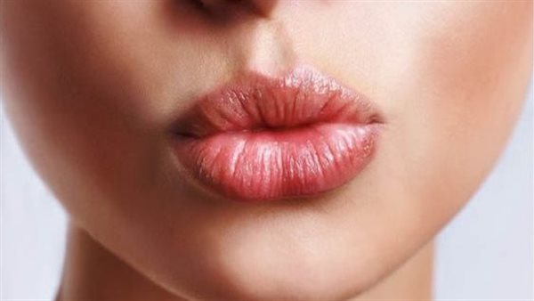 أسباب تشقق الشفاه