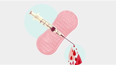 طبيب يوضح العلاقة بين لقاح كورونا وموعد الدورة الشهرية