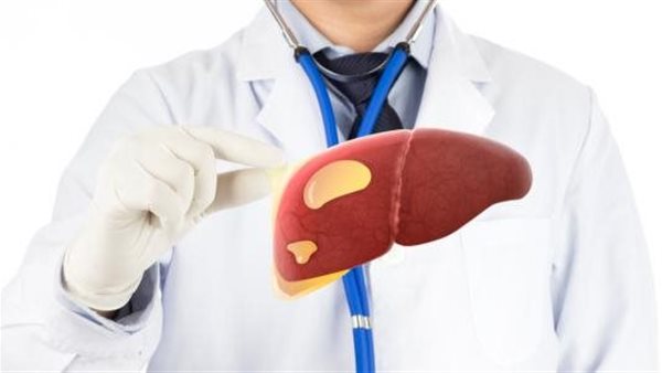 أعراض دهون الكبد