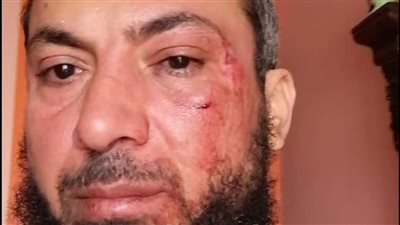 تفاصيل الاعتداء على مواطن بقليوب والتهديد بحرق منزله: عايزنّى أتنازل عن قضايا ضدهم | صور وفيديو