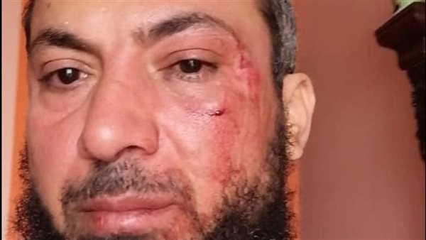 الاعتداء على مواطن