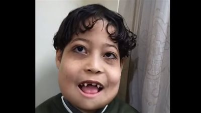 والدة طفل مصاب بورم في الفكين بالفيوم: زمايله بيتريقوا عليه وبيزعلوه | بث مباشر