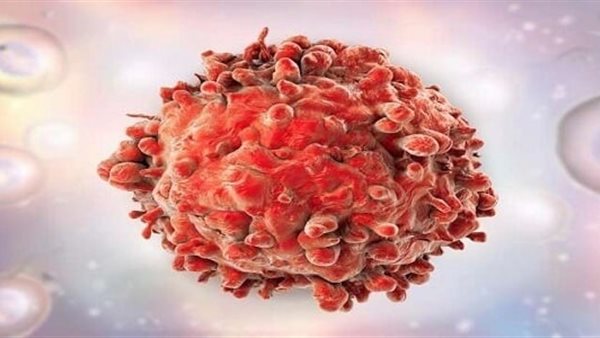 السرطان - تعبيرية