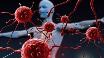 يعزز مقاومة المرض.. خبراء يكشفون عن علاج لمكافحة السرطان ببريطانيا 