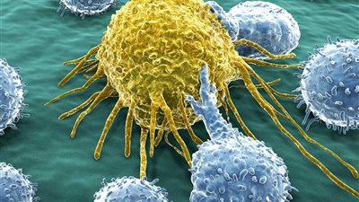 أبرزها تقرحات الفم.. دراسة تكشف عن علامات مبكرة قد تدل على الإصابة بالسرطان