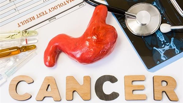 اسباب سرطان المعدة
