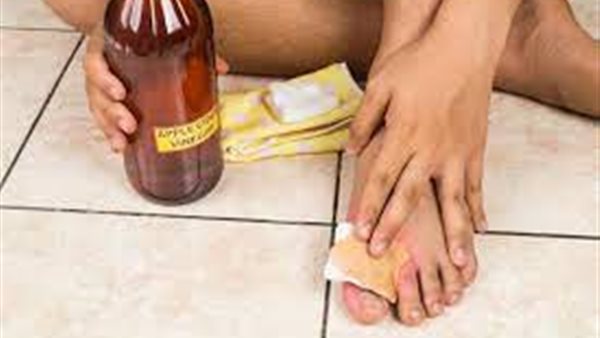فوائد خل التفاح لقدمين